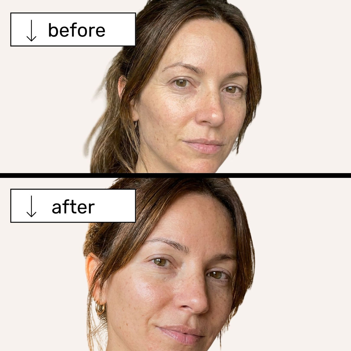 Clinic-grade skin, without the clinic.